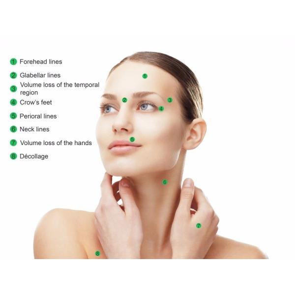 24mg/Ml 2ml Juvederm Dermal Filler Lip Injections Hyaluronic Acid Lip Fillers