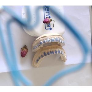 Custom ISO13485 Bleaching Tray For Whitening Teeth