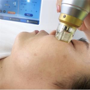 Portable Fractional Rf Microneedle Machine For Neck Wrinkle Reduction
