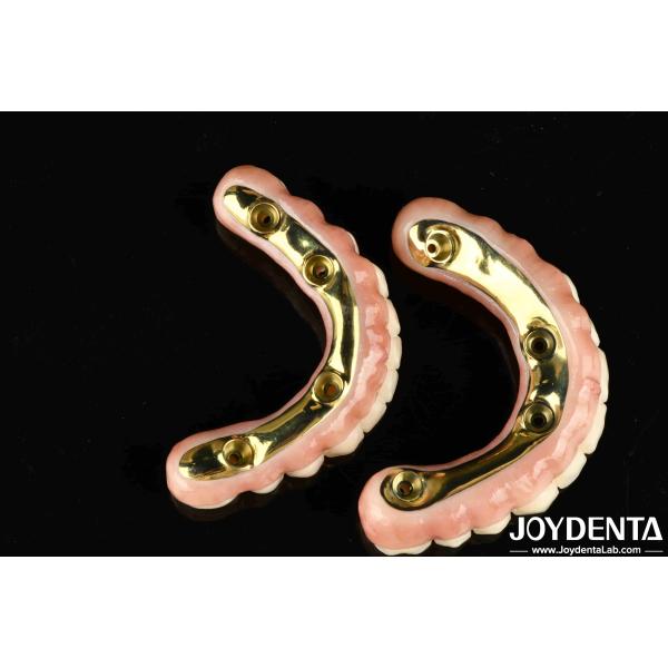 Quality Natural-looking Aesthetics Zirconia Hybrid Bridge With High Durability And Biocompatibility Ti-Bar Zirconia Hybrid Bridge wholesale