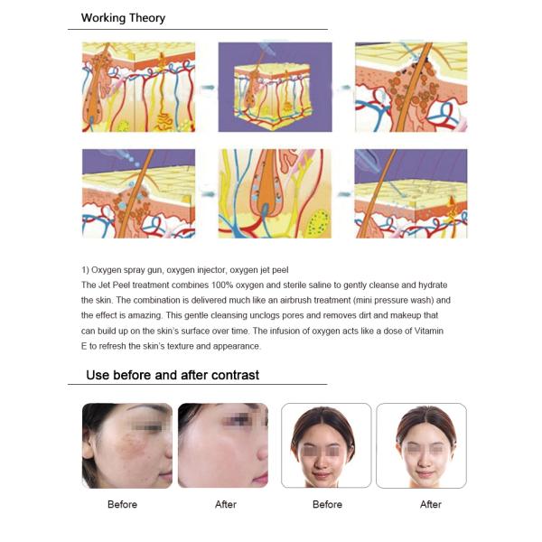 Hot Selling 8 Head Facial Beauty Machines Professional Portable Oxygen Facial Machine