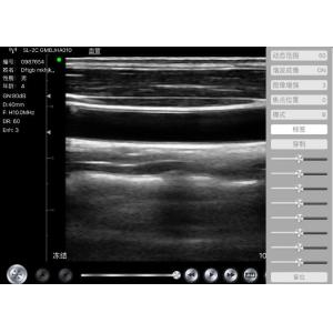 Handheld Color Doppler Wirless Ultrasound Probe With Built - In Lithium Battery