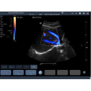 Custom USB Wifi Connection Handheld Baby Doppler With Changable Transducers