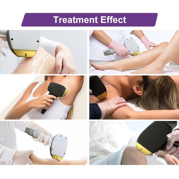 Professional Lazer Beauty Device 808 755 1064 Painless Diode Laser Hair Removal Machine