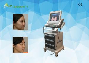 China Ultrasonic HIFU Face lift photo rejuvenation body slimming machine on sale
