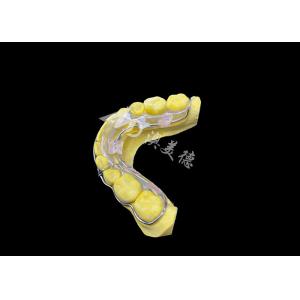 Beagle Retainer for Effective Smile Retention and Long-Lasting Alignment