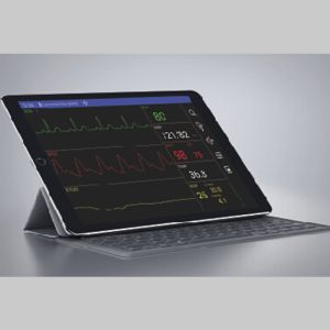 Veterinary Spo2 Monitor With Internal Memory And Bluetooth Data Transfer