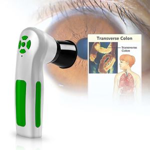 High Resolution CCD USB Iriscope Diagnostic Eye Camera With 12MP HD 30x Iris