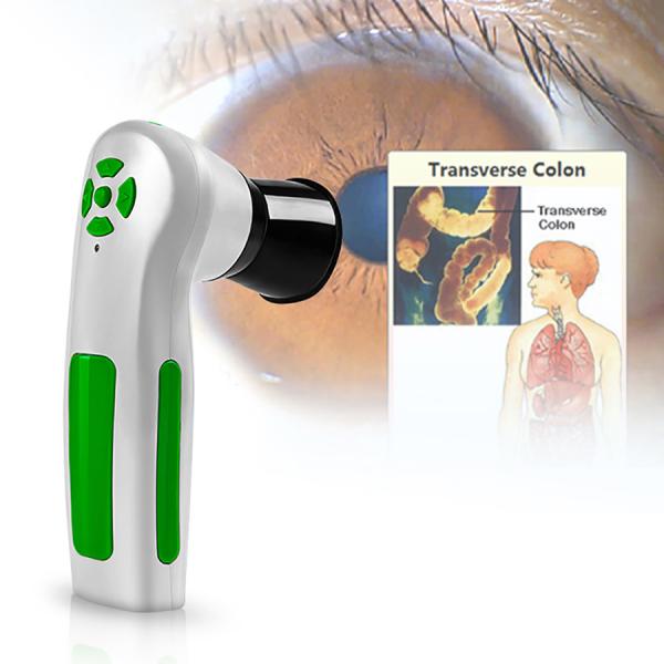 High Resolution CCD USB Iriscope Diagnostic Eye Camera With 12MP HD 30x Iris
