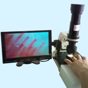 Hospital Nailfold Capillary Microscopy / Microcirculation Microscope Multi