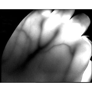 Bacteria Analysis System Instruments Vein Finder Device No Radiation