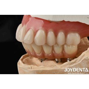 Good Elasticity Dental Acrylic Denture Finish With Tooth Arrangement Technology
