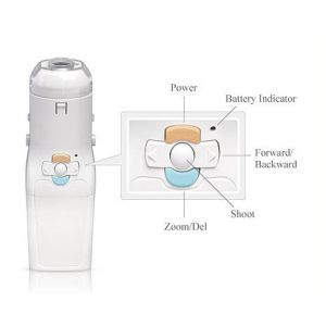 Self - Inspection Tool for Cervical Examination Digital Electronic Colposcope