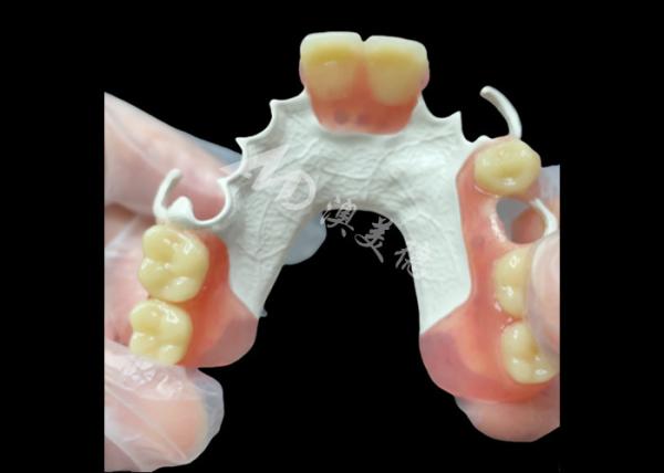 Quality Aesthetic Custom made Removable Partial Denture HPP Framework for Natural Partial Tooth Replacement wholesale