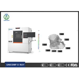 Detect Internal Defects In Automobile Engine Parts With UNCT3100