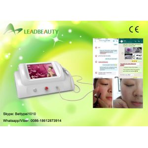 Smart RBS System High Frequency 30MHZ Spider Vein Removal Machine for Clinic /