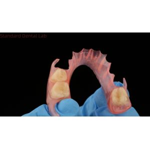 3D Print Model Dental TCS Valplast Flexible Partial Dentures Pink / Dark Color