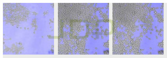 Real-time Live Cell Imaging And Analysis System