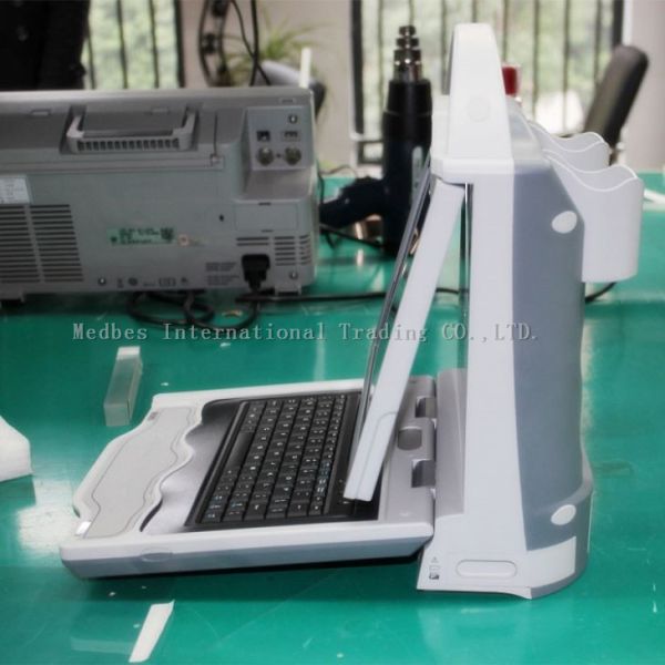 Automatic High Effective Ultrasound Bone Densitometer/Portable Ultrasound Bone