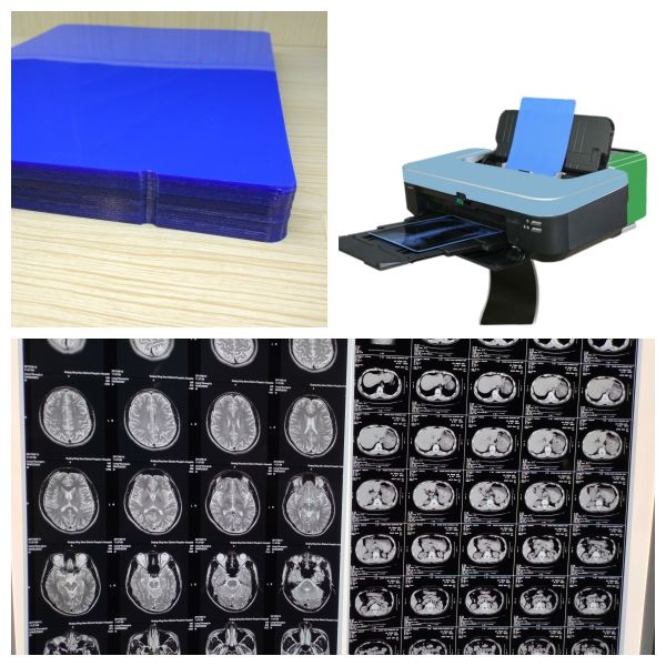 Quality Long Lasting Inkjet X Ray Film With Low Fog And High Printing Quality 150 Microns wholesale