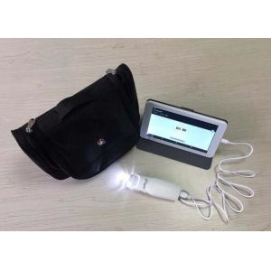 Portable Digital Electronic Colposcope