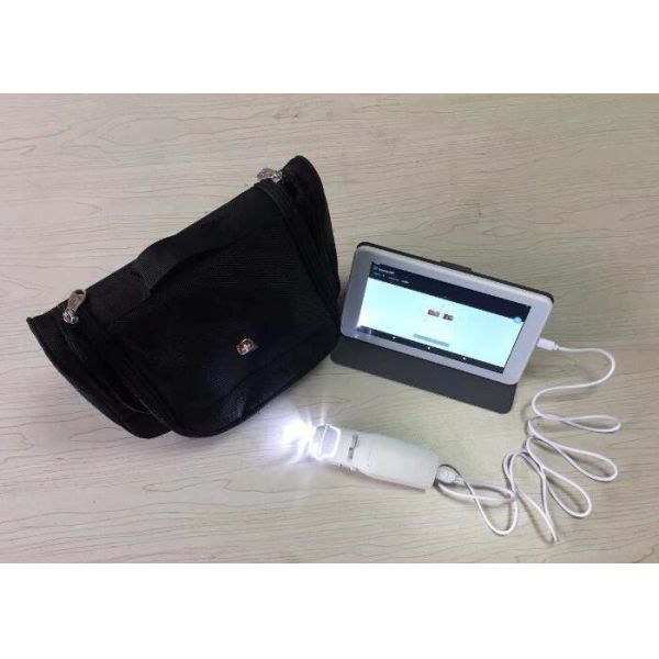 Quality PAL Color System AV Signal Digital Electronic Colposcope With TF Card And Monitor wholesale