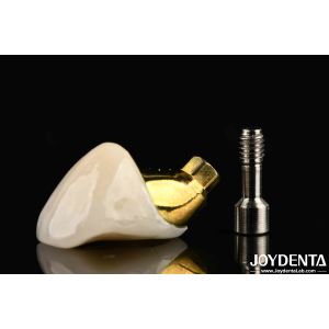 Long-Lasting Implant Crown And Bridge For Restoring Missing Teeth Suitable For