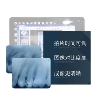 BLX-8 plus High-frequency Digital wireless portable dental x ray machine