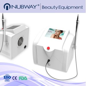 Cheap Professional 30mhz Spider Vein Laser Removal Machine For Varicose Veins for sale