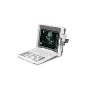 12 Inch Notebook Portable Ultrasound Scanner With Window 10 system(PC)