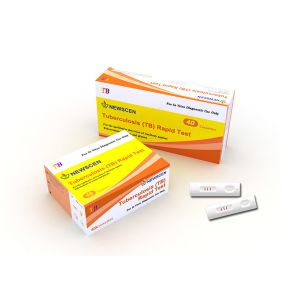 TUV Colloidal Gold Whole Blood Tuberculosis Rapid Test Kit