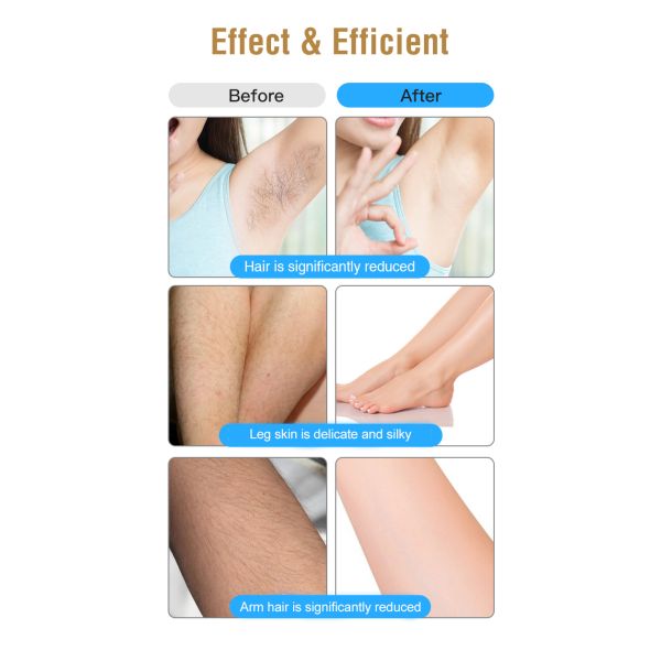 New Arrival Home Use Painless IPL ICE COOL Laser Hair Removal Handset