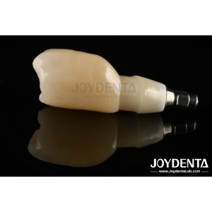 China Shoulder Margin Design Dental Implant Bars For Wide Prosthetic Platform Needs on sale