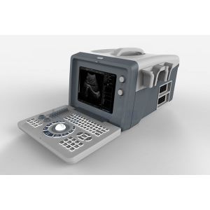 Durable Portable 2D Echo Machine Micro Convex Medical Ultrasound Machine