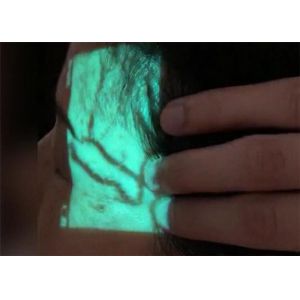 Vascular Access Device Vascular Visualization Equipment Accuracy 0.25mm Battery