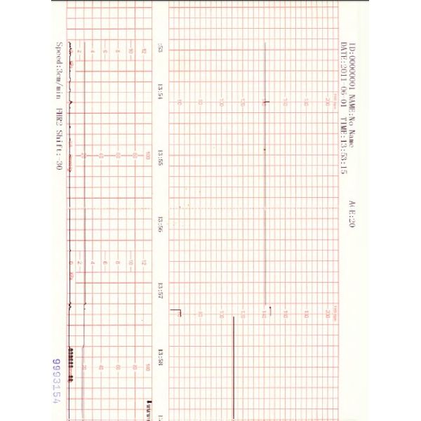 ctg machine maternal and fetal doppler monitor for TOCO,FHR,FM DM002