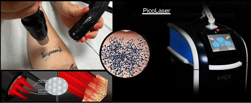 paste-pic-dp_uuid_31hqi