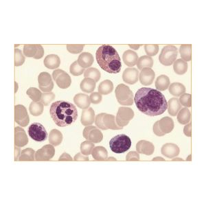 Liu's Haematocyte Stain Kit For Classification Of Hematocytes