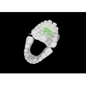 Effective Removable Orthodontic Expander For Optimal Jaw Alignment And Dental