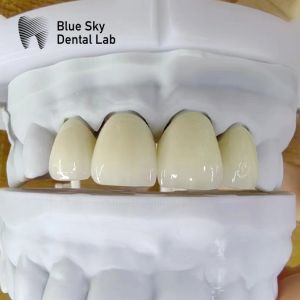 Natural Looking Layered Zirconia High Strength Zircon Multilayer Rectangular