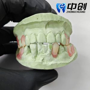 Flexible Denture High Durability Invisible Denture Base Resin for Natural