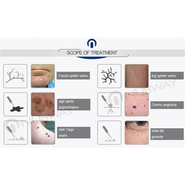 Factory Price Spider Vein Removal Machine / Veins Removal Machine / Facial Vein Removal