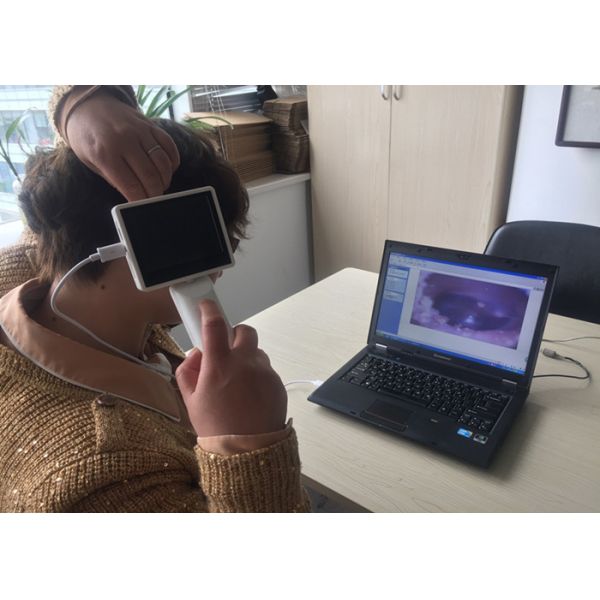 Quality Optional Wifi Model Mini Otoscope Ophthalmoscope With Ultra - High Resolution wholesale