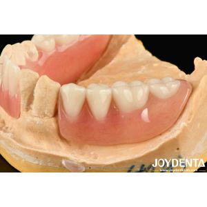 Diverse And Lightweight Resin Material Acrylic Denture Finish
