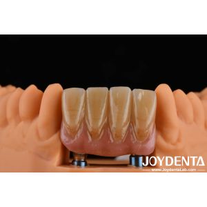 4.5mm Height Finished Abutments Internal Hex Connection Type Compatible With