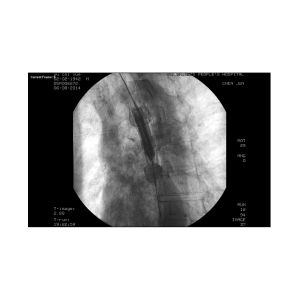 Non Vascular Sterile Hydro Slide Guidewire