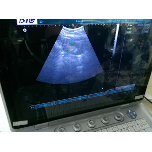 3D Digital B / W Portable Ultrasound Scanner With Convex Linear Transvaginal