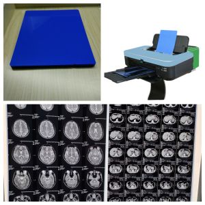 Canon/Epson Inkjet X Ray Film Low Fog 1-3 Minutes Printing Speed