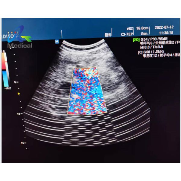 Quality Medison X6 Ultrasonic Board Repair Solutions Image Interference wholesale