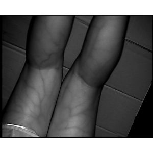 Portable Dual head Infrared Vein Finder For Medical Illuminated Locator